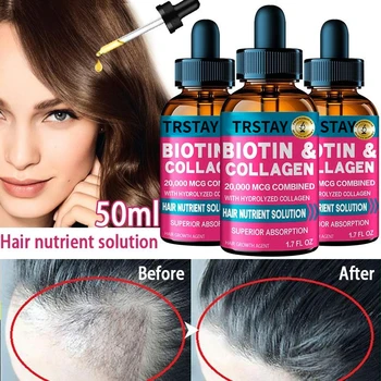 Saç Dökülmesi Saç Alopesi Saç Tedavisi Kadınlar için Saç Büyüme Yağı Kafa Saç Bakımı Büyüme Saç Saç Spreyi